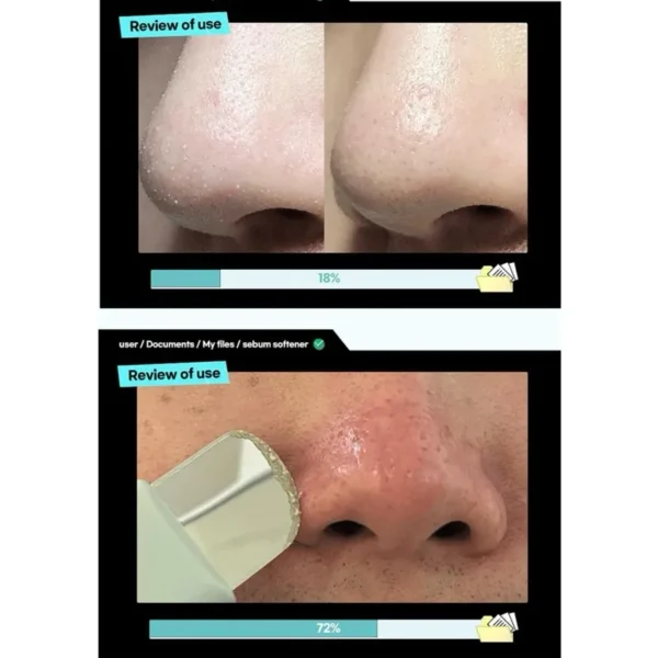 ILSO - Super Melting Sebum Softener